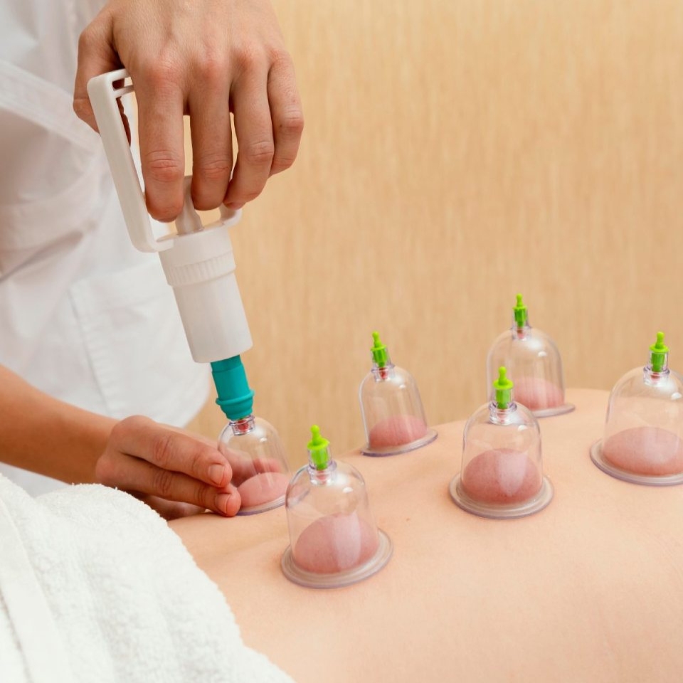 Cold Laser Cupping